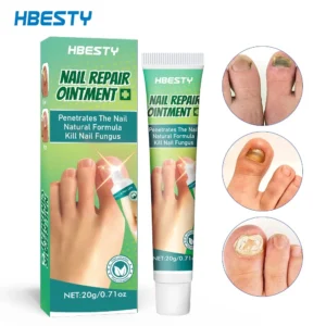 Kem phục hồi móng cải thiện hư tổn móng kích thích mọc móng nhanh chóng