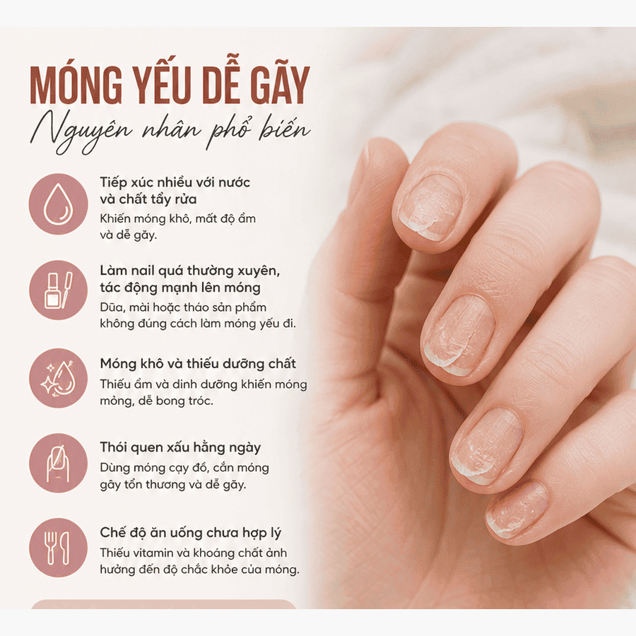 Móng yếu dễ gãy